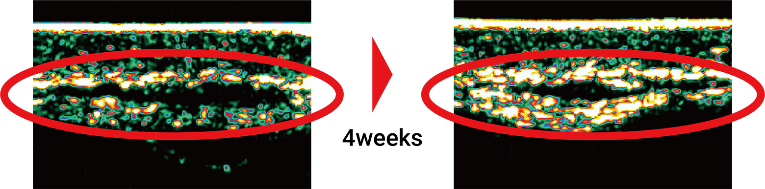 Collagen Production