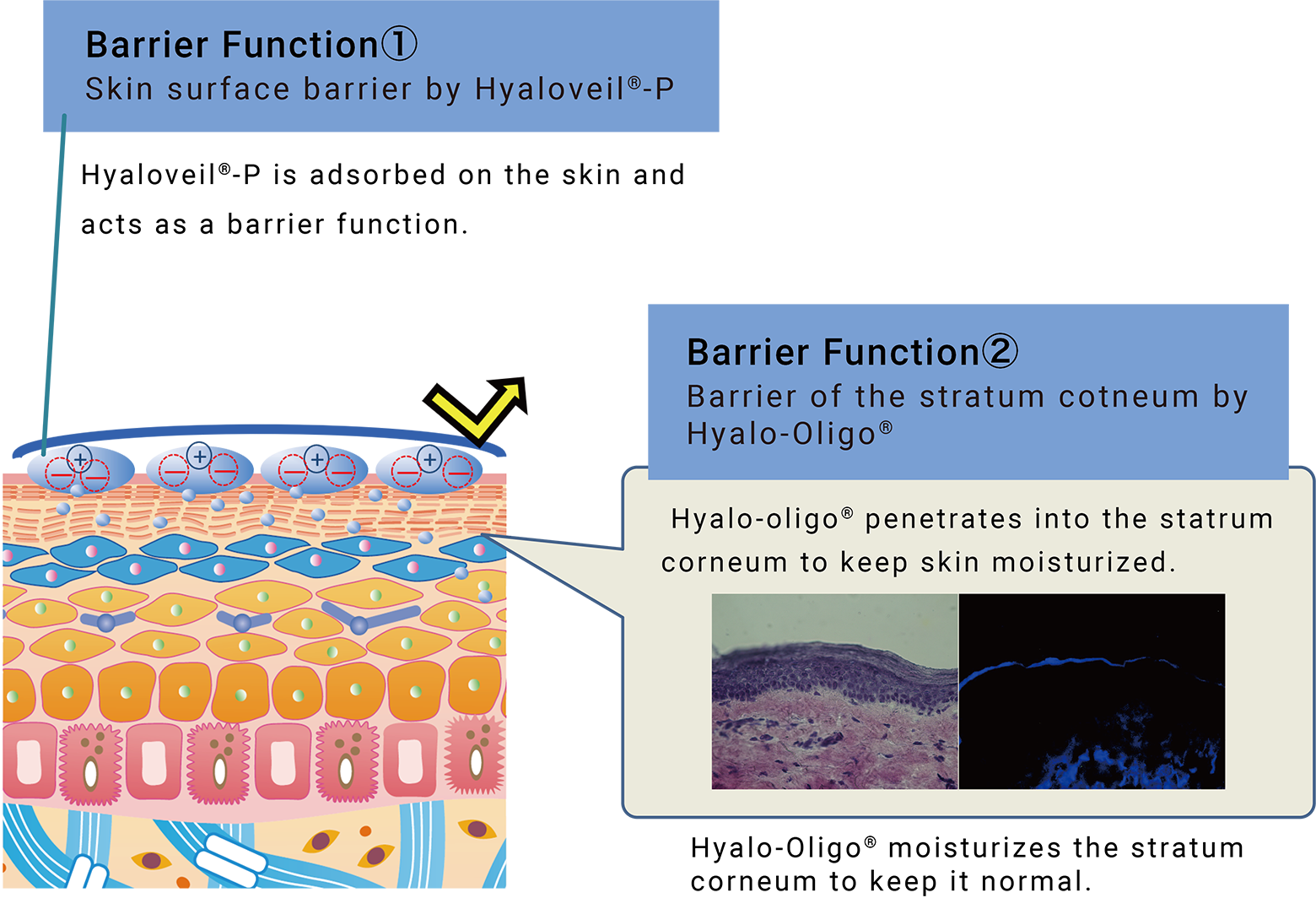 Mechanism of Anti-Pollution